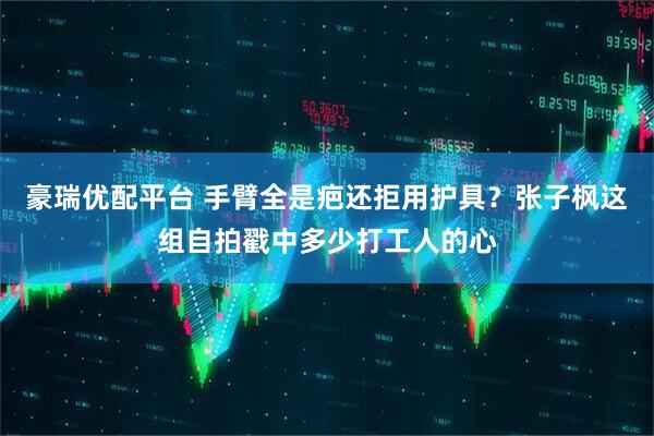 豪瑞优配平台 手臂全是疤还拒用护具？张子枫这组自拍戳中多少打工人的心